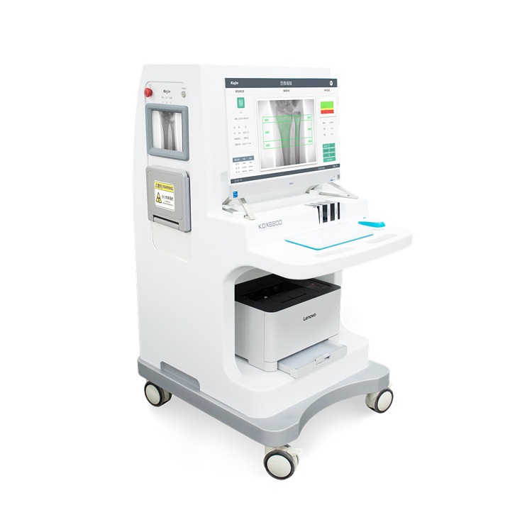 科進(jìn)Kejin 雙能X射線骨密度儀KDX8000+ 側(cè)屏顯示